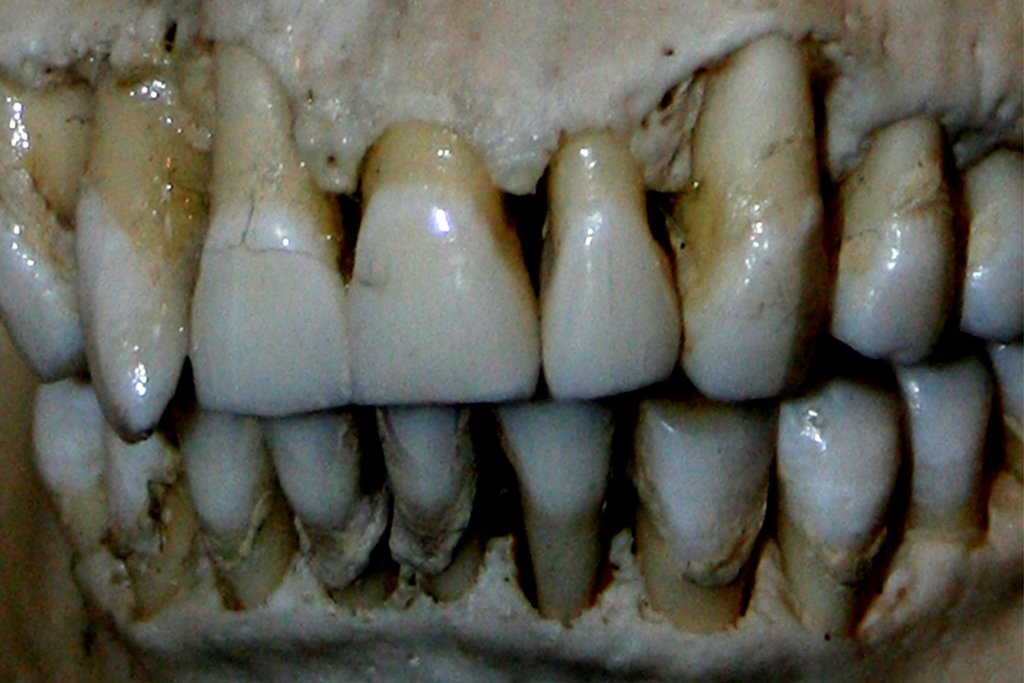 OG Teeth