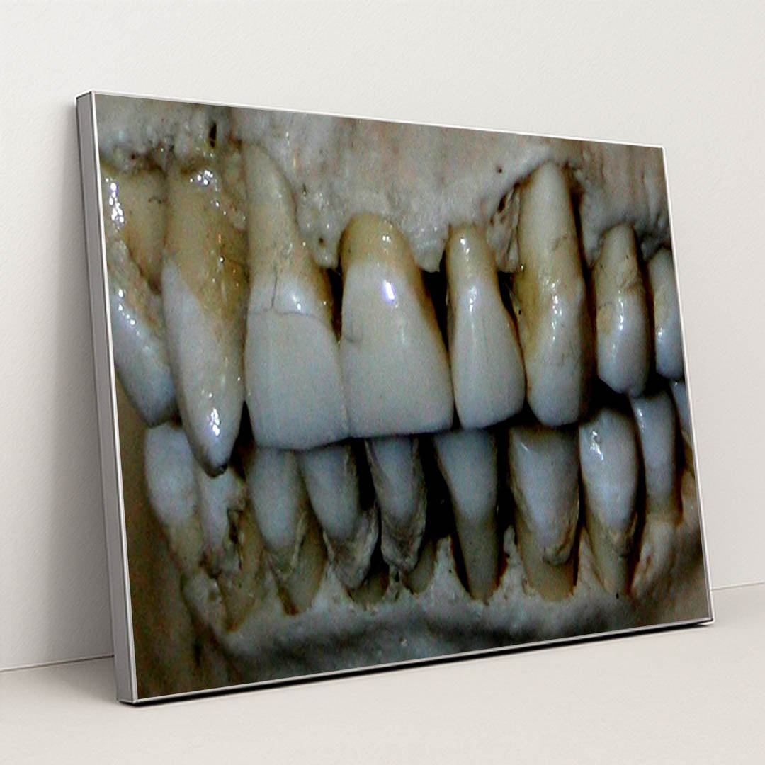 OG Teeth