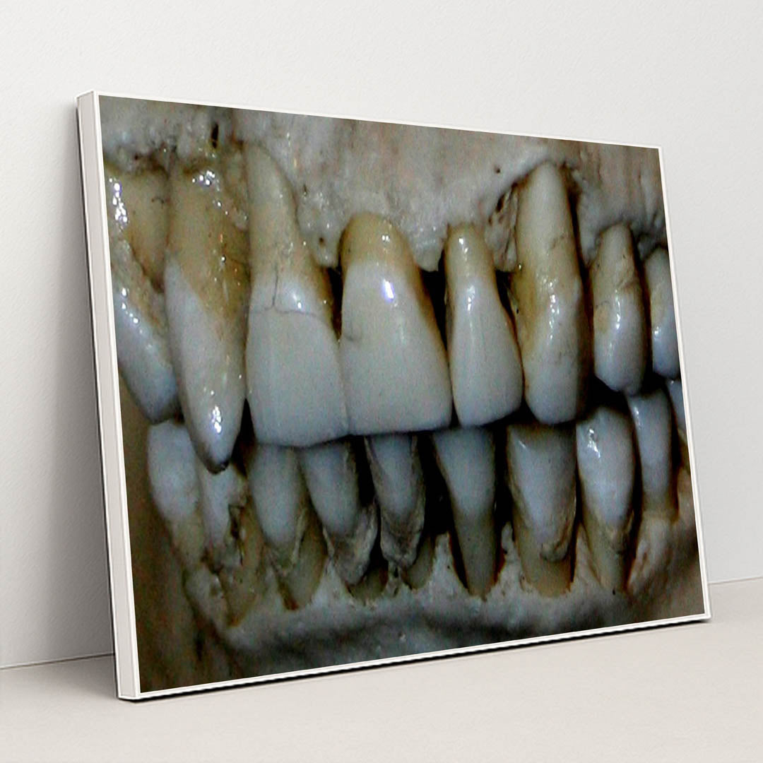 OG Teeth