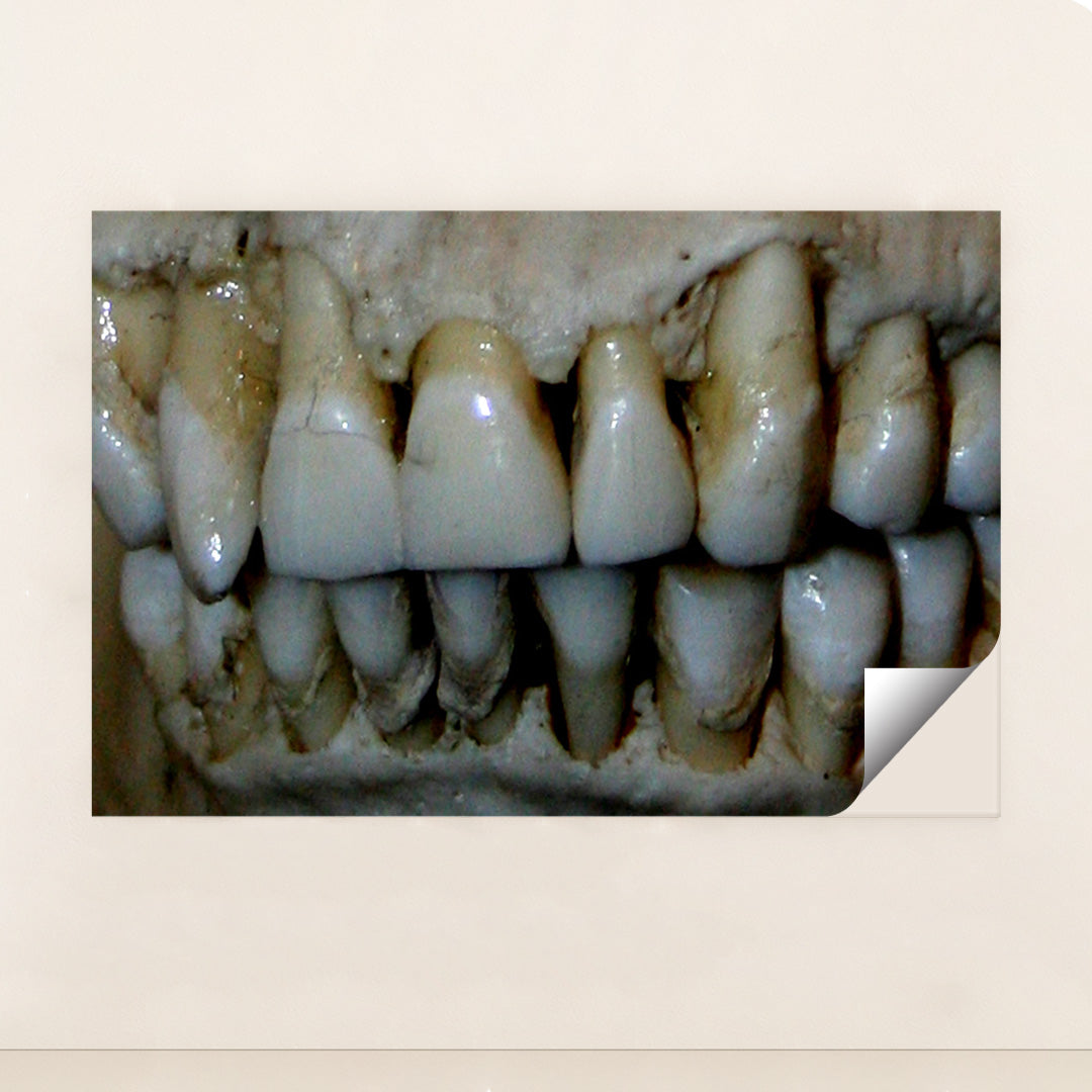 OG Teeth